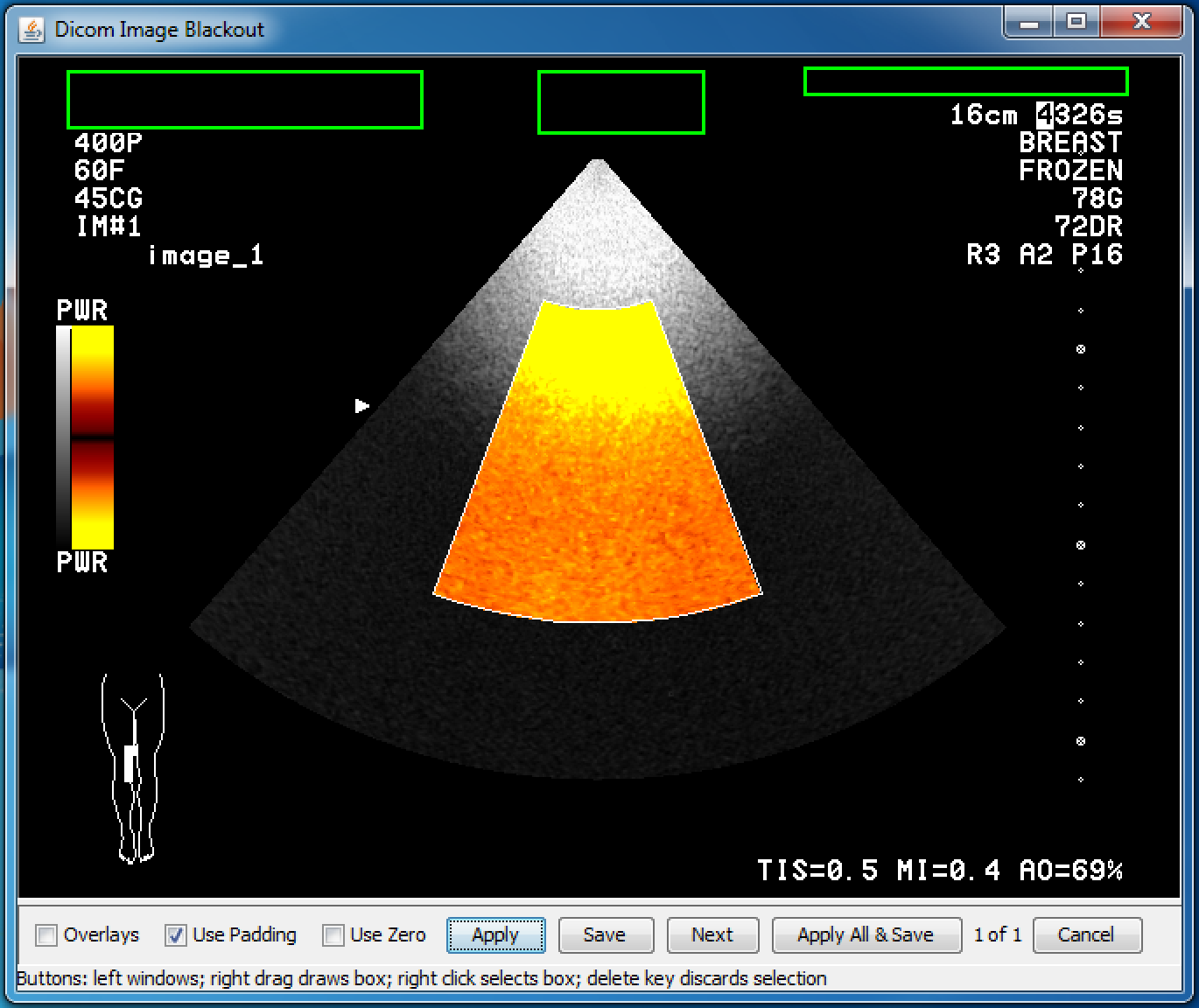 DicomImageBlackoutColorUltrasound