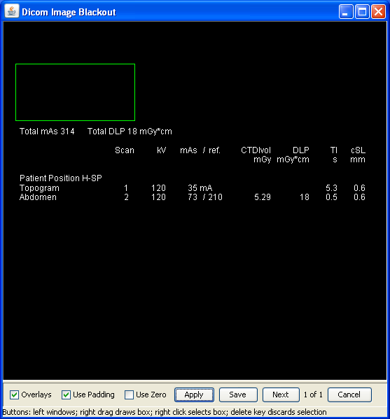 DicomImageBlackoutOverlayDose